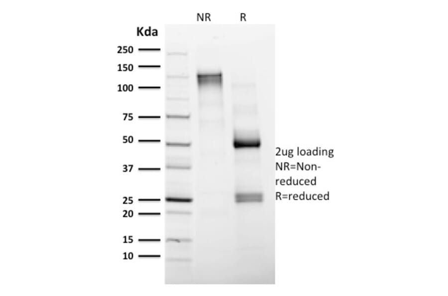 SDS-PAGE - Anti-CD4 Antibody [CD4/1604] (CF®740) (A353396) - Antibodies.com