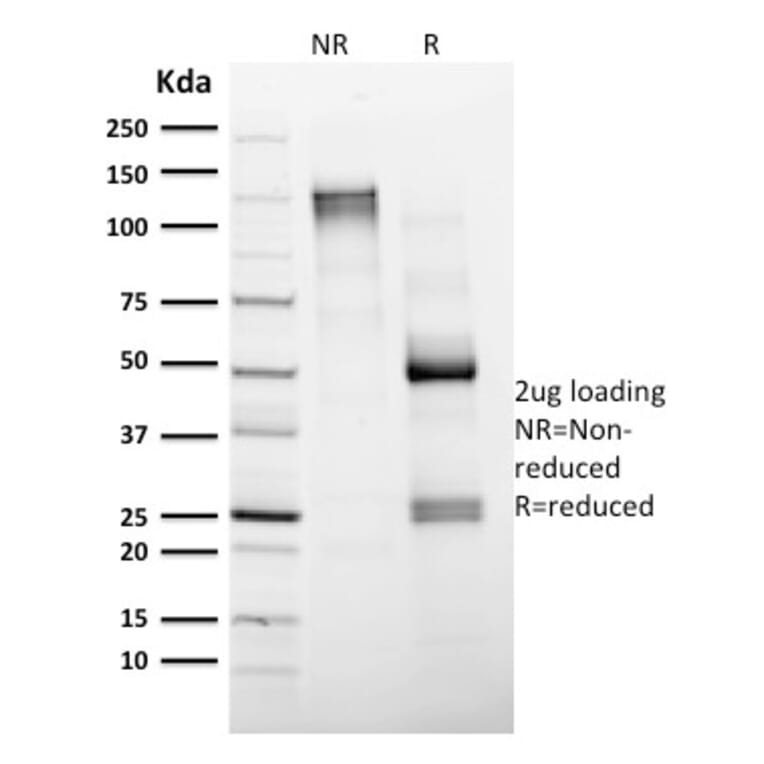 SDS-PAGE - Anti-CD4 Antibody [CD4/1604] (CF®740) (A353396) - Antibodies.com