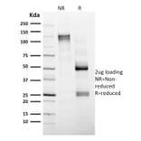 SDS-PAGE - Anti-CD4 Antibody [CD4/1604] (CF®740) (A353396) - Antibodies.com