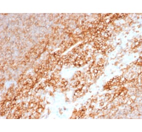 Immunohistochemistry (formalin-fixed, paraffin-embedded) - Anti-CD44 Antibody [BU75] (CF®647) (A353410) - Antibodies.com