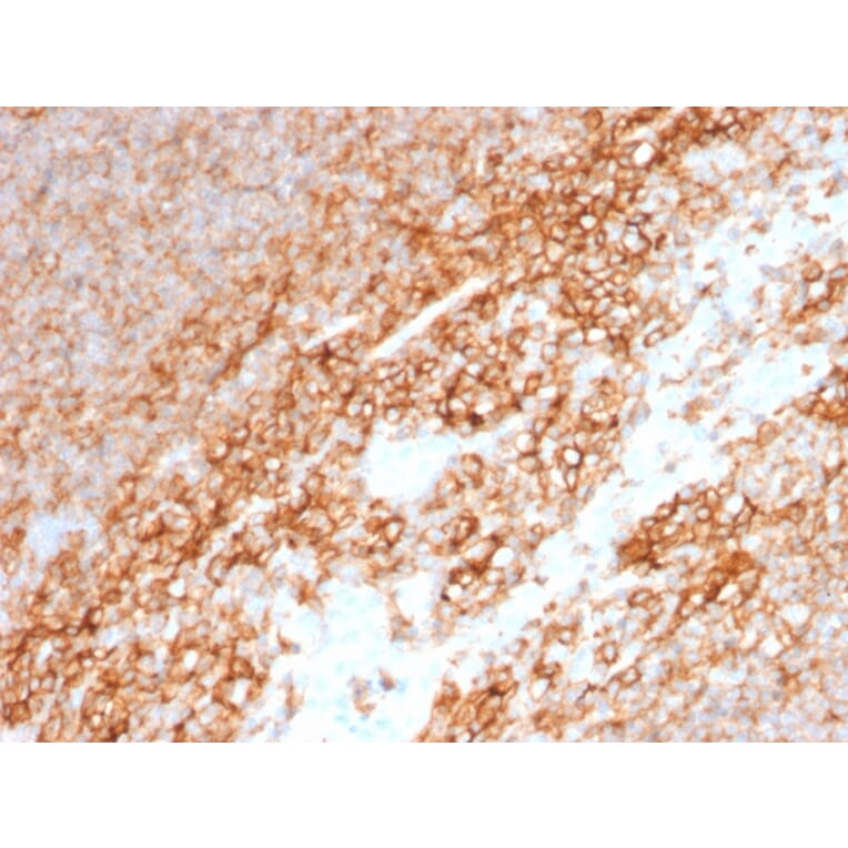 Immunohistochemistry (formalin-fixed, paraffin-embedded) - Anti-CD44 Antibody [BU75] (CF®568) (A353411) - Antibodies.com