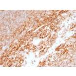 Immunohistochemistry (formalin-fixed, paraffin-embedded) - Anti-CD44 Antibody [BU75] (CF®568) (A353411) - Antibodies.com
