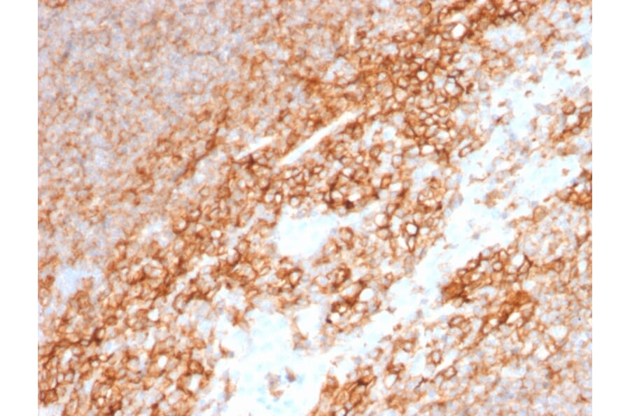 Immunohistochemistry (formalin-fixed, paraffin-embedded) - Anti-CD44 Antibody [BU75] (CF®594) (A353414) - Antibodies.com