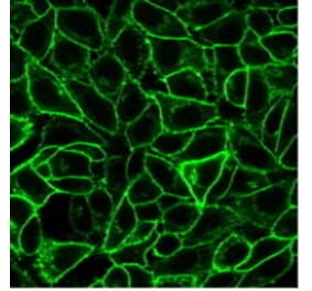 Immunofluorescence - Anti-CD105 Antibody [ENG/1621] (CF®740) (A353420) - Antibodies.com