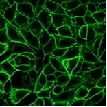 Immunofluorescence - Anti-CD105 Antibody [ENG/1621] (CF®488A) (A353421) - Antibodies.com