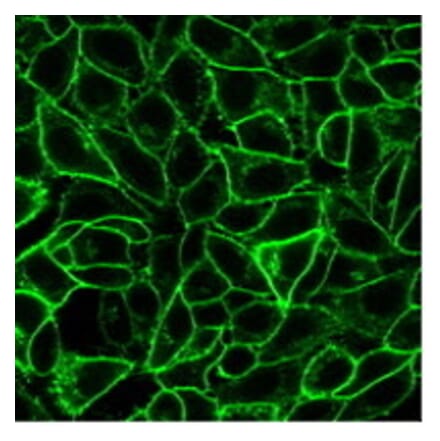 Immunofluorescence - Anti-CD105 Antibody [ENG/1621] (CF®594) (A353422) - Antibodies.com