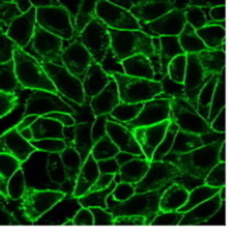 Immunofluorescence - Anti-CD105 Antibody [ENG/1621] (CF®594) (A353422) - Antibodies.com