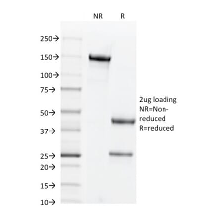 SDS-PAGE - Anti-CD44v6 Antibody [2F10] (CF®405S) (A353432) - Antibodies.com