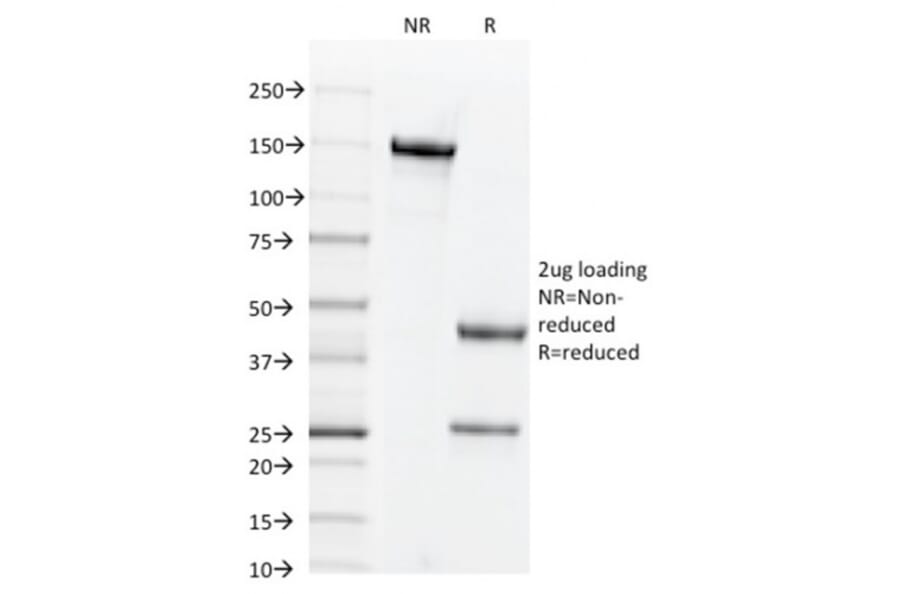 SDS-PAGE - Anti-CD44v6 Antibody [2F10] (CF®568) (A353435) - Antibodies.com