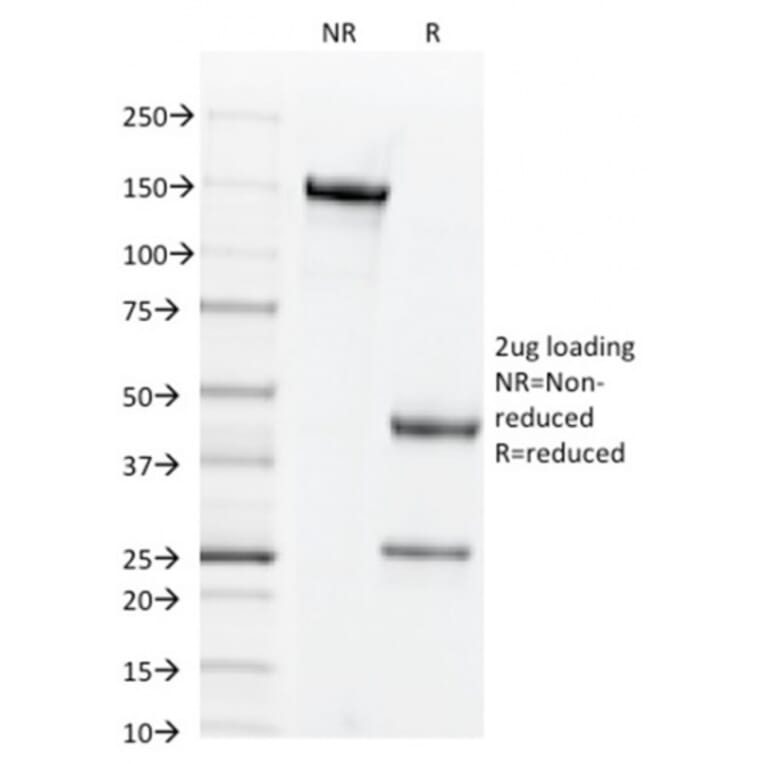 SDS-PAGE - Anti-CD44v6 Antibody [2F10] (Biotin) (A353439) - Antibodies.com
