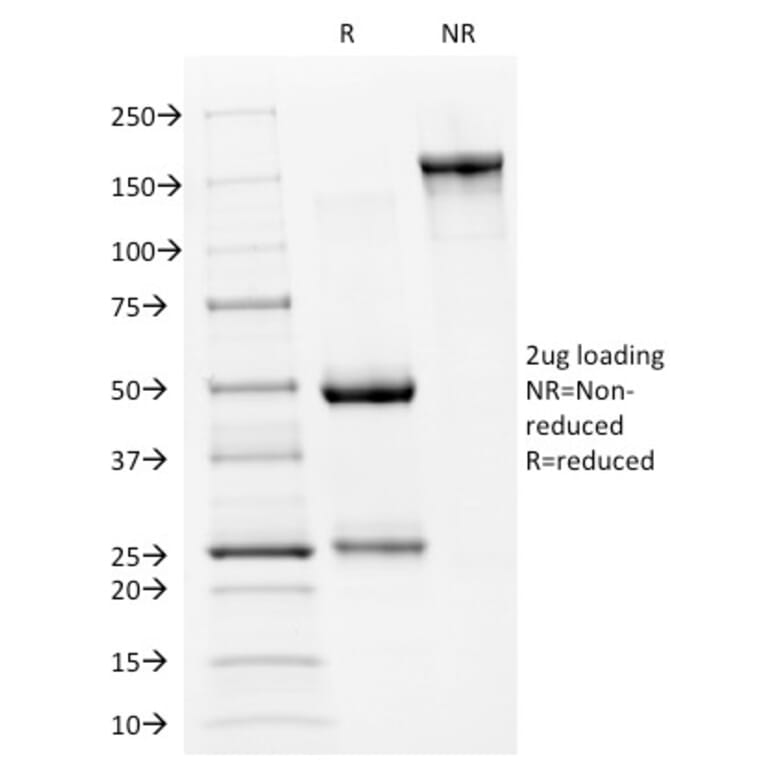 SDS-PAGE - Anti-p53 Antibody [PAb240] (CF®488A) (A353445) - Antibodies.com