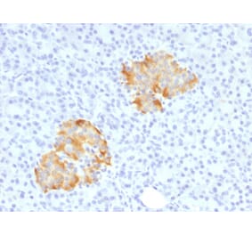 Immunohistochemistry (formalin-fixed, paraffin-embedded) - Anti-TNF alpha Antibody (Biotin) (A353479) - Antibodies.com
