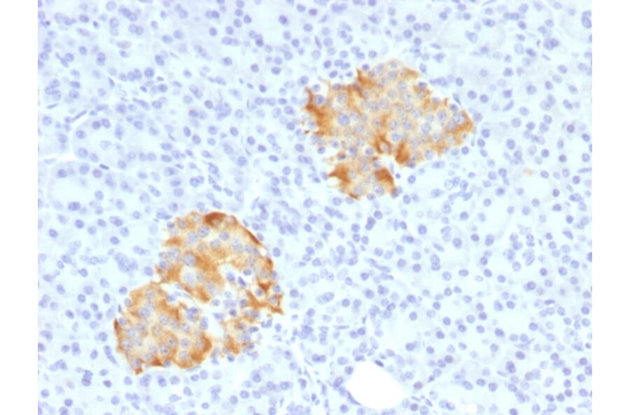 Immunohistochemistry (formalin-fixed, paraffin-embedded) - Anti-TNF alpha Antibody (Biotin) (A353479) - Antibodies.com