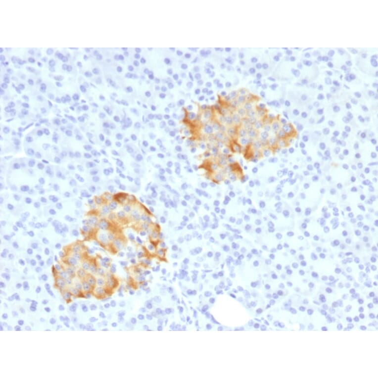 Immunohistochemistry (formalin-fixed, paraffin-embedded) - Anti-TNF alpha Antibody (Biotin) (A353479) - Antibodies.com