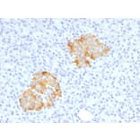 Immunohistochemistry (formalin-fixed, paraffin-embedded) - Anti-TNF alpha Antibody (Biotin) (A353479) - Antibodies.com