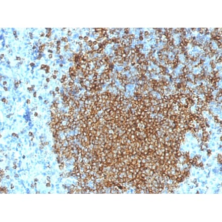 Immunohistochemistry (formalin-fixed, paraffin-embedded) - Anti-CD45RA Antibody [K4B5] (CF®640R) (A353481) - Antibodies.com