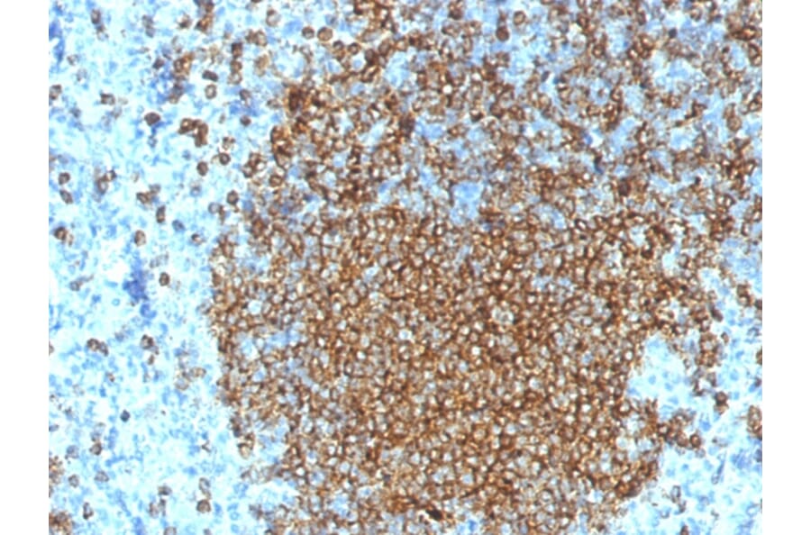 Immunohistochemistry (formalin-fixed, paraffin-embedded) - Anti-CD45RA Antibody [K4B5] (CF®568) (A353483) - Antibodies.com