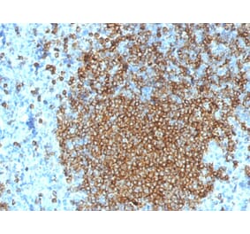 Immunohistochemistry (formalin-fixed, paraffin-embedded) - Anti-CD45RA Antibody [K4B5] (CF®740) (A353484) - Antibodies.com