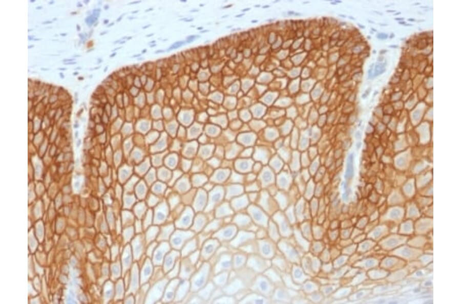 Immunohistochemistry (formalin-fixed, paraffin-embedded) - Anti-CD44v4 Antibody [CD44v4/1700R] (CF®405S) (A353488) - Antibodies.com