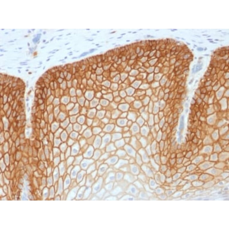 Immunohistochemistry (formalin-fixed, paraffin-embedded) - Anti-CD44v4 Antibody [CD44v4/1700R] (CF®405S) (A353488) - Antibodies.com