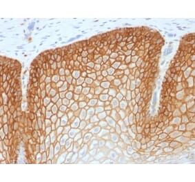 Immunohistochemistry (formalin-fixed, paraffin-embedded) - Anti-CD44v4 Antibody [CD44v4/1700R] (CF®640R) (A353489) - Antibodies.com