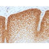 Immunohistochemistry (formalin-fixed, paraffin-embedded) - Anti-CD44v4 Antibody [CD44v4/1700R] (CF®740) (A353492) - Antibodies.com