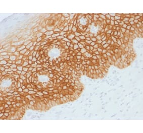 Immunohistochemistry (formalin-fixed, paraffin-embedded) - Anti-CD44v4 Antibody (CF®568) (A353515) - Antibodies.com