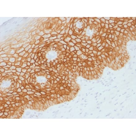 Immunohistochemistry (formalin-fixed, paraffin-embedded) - Anti-CD44v4 Antibody (CF®740) (A353516) - Antibodies.com