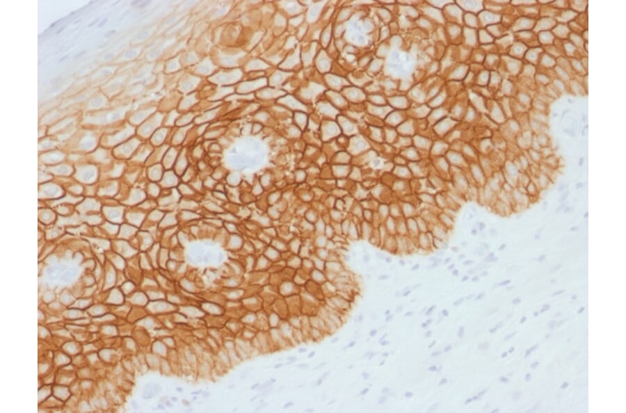 Immunohistochemistry (formalin-fixed, paraffin-embedded) - Anti-CD44v4 Antibody (CF®594) (A353518) - Antibodies.com
