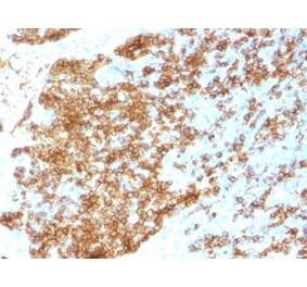 Immunohistochemistry (formalin-fixed, paraffin-embedded) - Anti-CD45RB Antibody [PTPRC/1783R] (CF®405S) (A353536) - Antibodies.com