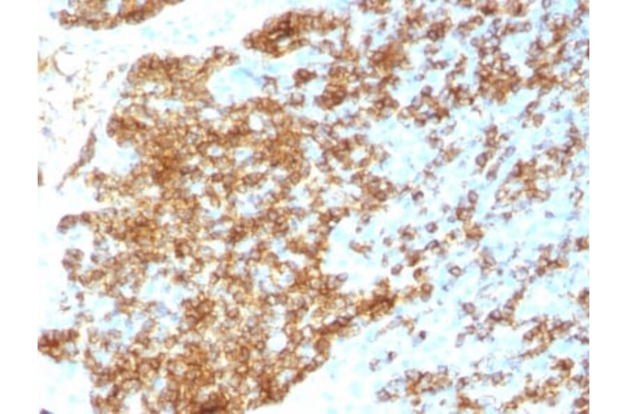 Immunohistochemistry (formalin-fixed, paraffin-embedded) - Anti-CD45RB Antibody [PTPRC/1783R] (CF®568) (A353539) - Antibodies.com