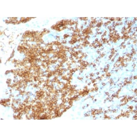 Immunohistochemistry (formalin-fixed, paraffin-embedded) - Anti-CD45RB Antibody [PTPRC/1783R] (CF®740) (A353540) - Antibodies.com
