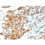 Immunohistochemistry (formalin-fixed, paraffin-embedded) - Anti-CD45RB Antibody [PTPRC/1783R] (CF®740) (A353540) - Antibodies.com