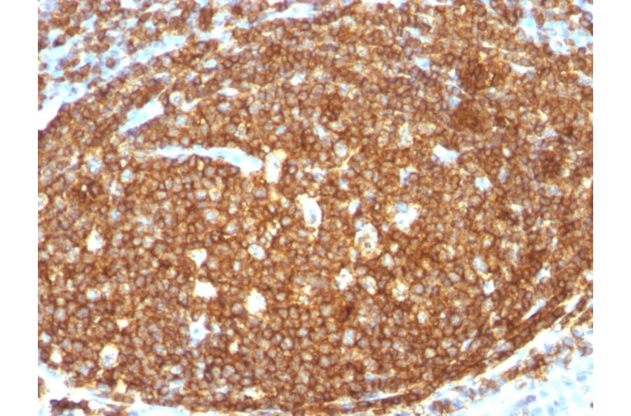 Immunohistochemistry (formalin-fixed, paraffin-embedded) - Anti-CD45RB Antibody [N/A] (CF®640R) (A353545) - Antibodies.com