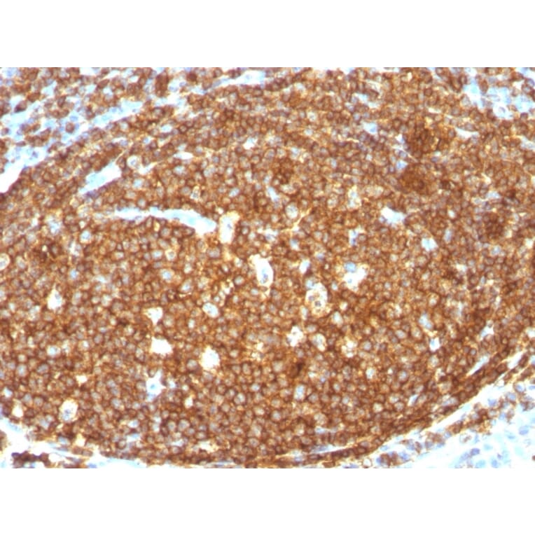 Immunohistochemistry (formalin-fixed, paraffin-embedded) - Anti-CD45RB Antibody [N/A] (CF®568) (A353547) - Antibodies.com