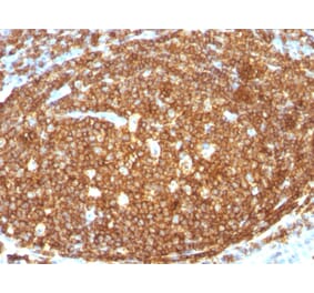 Immunohistochemistry (formalin-fixed, paraffin-embedded) - Anti-CD45RB Antibody [N/A] (CF®740) (A353548) - Antibodies.com