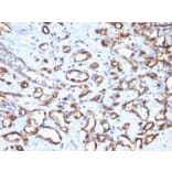 Immunohistochemistry (formalin-fixed, paraffin-embedded) - Anti-CD34 Antibody [N/A] (CF®405S) (A353568) - Antibodies.com