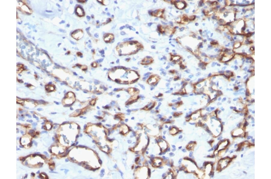 Immunohistochemistry (formalin-fixed, paraffin-embedded) - Anti-CD34 Antibody [N/A] (CF®640R) (A353569) - Antibodies.com