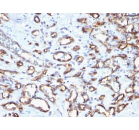 Immunohistochemistry (formalin-fixed, paraffin-embedded) - Anti-CD34 Antibody [N/A] (CF®568) (A353571) - Antibodies.com
