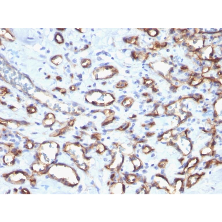 Immunohistochemistry (formalin-fixed, paraffin-embedded) - Anti-CD34 Antibody [N/A] (CF®568) (A353571) - Antibodies.com