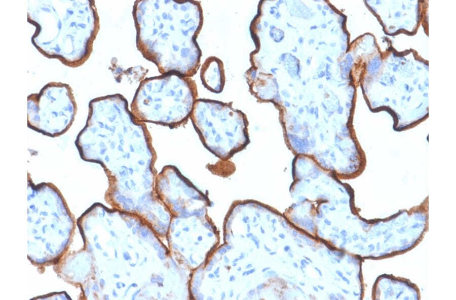 Immunohistochemistry (formalin-fixed, paraffin-embedded) - Anti-Transferrin Receptor Antibody [TFRC/1839] (CF®647) (A353602) - Antibodies.com