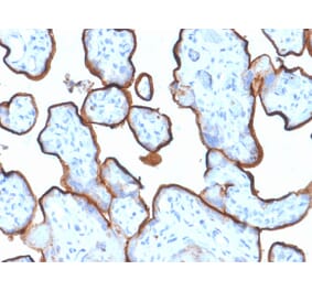 Immunohistochemistry (formalin-fixed, paraffin-embedded) - Anti-Transferrin Receptor Antibody [TFRC/1839] (CF®740) (A353604) - Antibodies.com