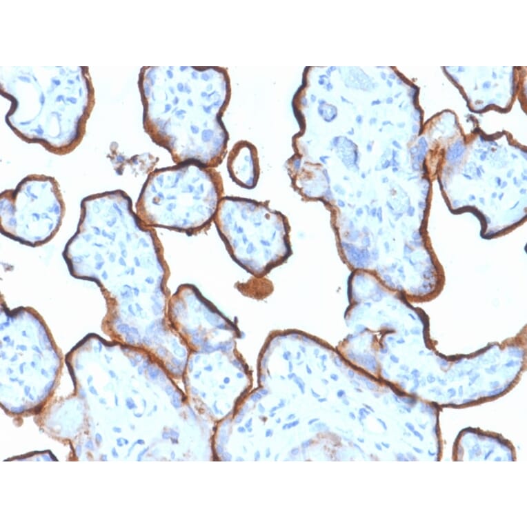 Immunohistochemistry (formalin-fixed, paraffin-embedded) - Anti-Transferrin Receptor Antibody [TFRC/1839] (Biotin) (A353607) - Antibodies.com