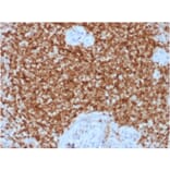 Immunohistochemistry (formalin-fixed, paraffin-embedded) - Anti-Bcl-2 Antibody [BCL2/1878R] (CF®568) (A353627) - Antibodies.com