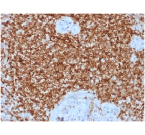 Immunohistochemistry (formalin-fixed, paraffin-embedded) - Anti-Bcl-2 Antibody [BCL2/1878R] (CF®488A) (A353629) - Antibodies.com