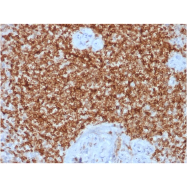 Immunohistochemistry (formalin-fixed, paraffin-embedded) - Anti-Bcl-2 Antibody [BCL2/1878R] (CF®488A) (A353629) - Antibodies.com