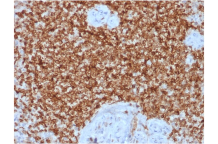 Immunohistochemistry (formalin-fixed, paraffin-embedded) - Anti-Bcl-2 Antibody [BCL2/1878R] (CF®594) (A353630) - Antibodies.com