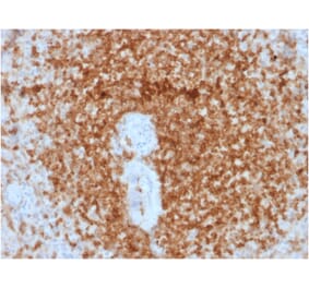 Immunohistochemistry (formalin-fixed, paraffin-embedded) - Anti-Bcl-2 Antibody [rBCL2/796] (CF®568) (A353635) - Antibodies.com