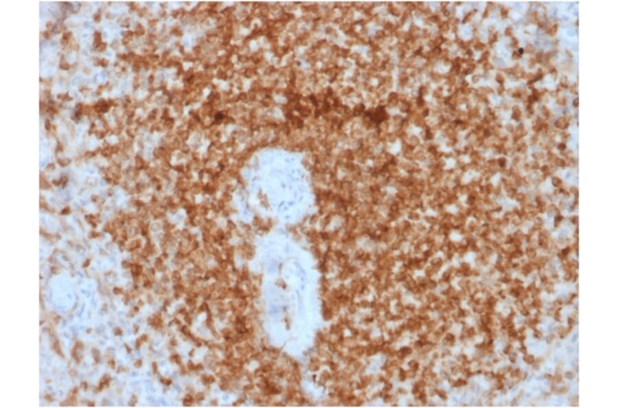Immunohistochemistry (formalin-fixed, paraffin-embedded) - Anti-Bcl-2 Antibody [rBCL2/796] (Biotin) (A353639) - Antibodies.com
