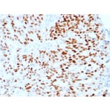 Immunohistochemistry (formalin-fixed, paraffin-embedded) - Anti-Estrogen Receptor alpha Antibody [ESR1/1904] (CF®568) (A353643) - Antibodies.com
